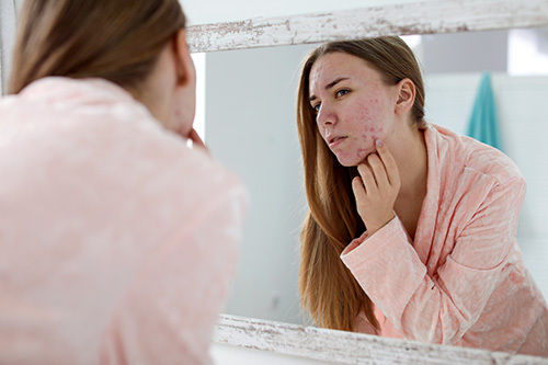 woman looking in the mirror at a type of acne on her face